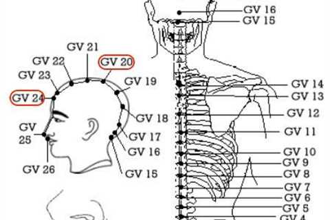 Migraine Headaches: 8 Pressure Points For Migraine Relief