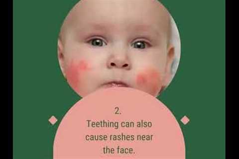 Is Your Baby Teething - Know the Signs and Remedies